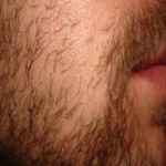 sakal ekimi sıklaştırma