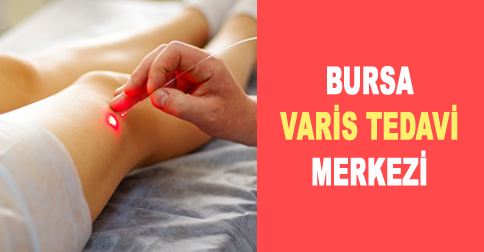 bursa-varis-tedavisi-merkezi