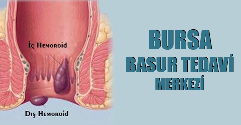 bursa-basur-tedavi-merkezi